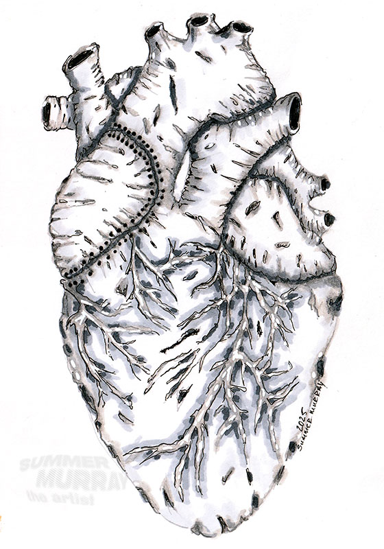Heart stitches